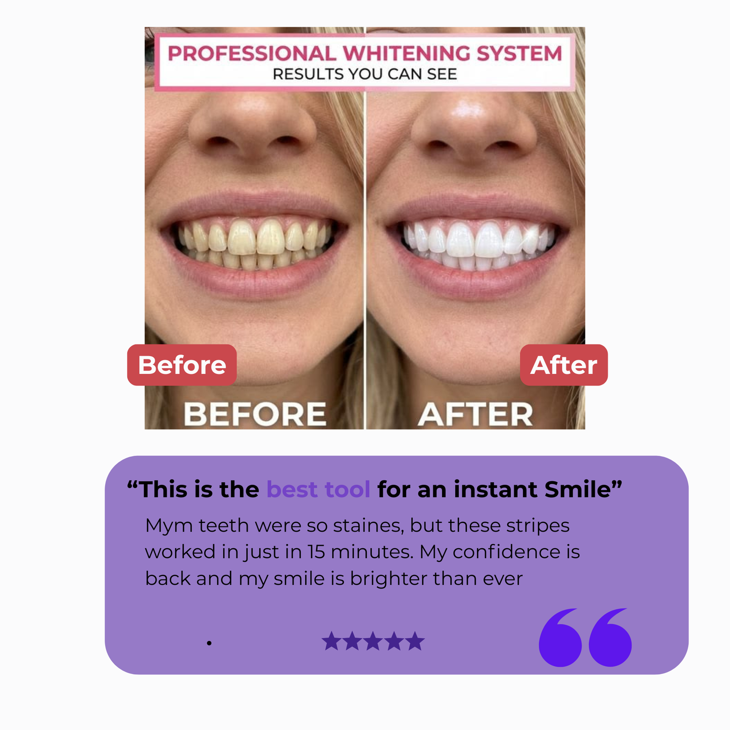 Teeth Brightening Care Strips